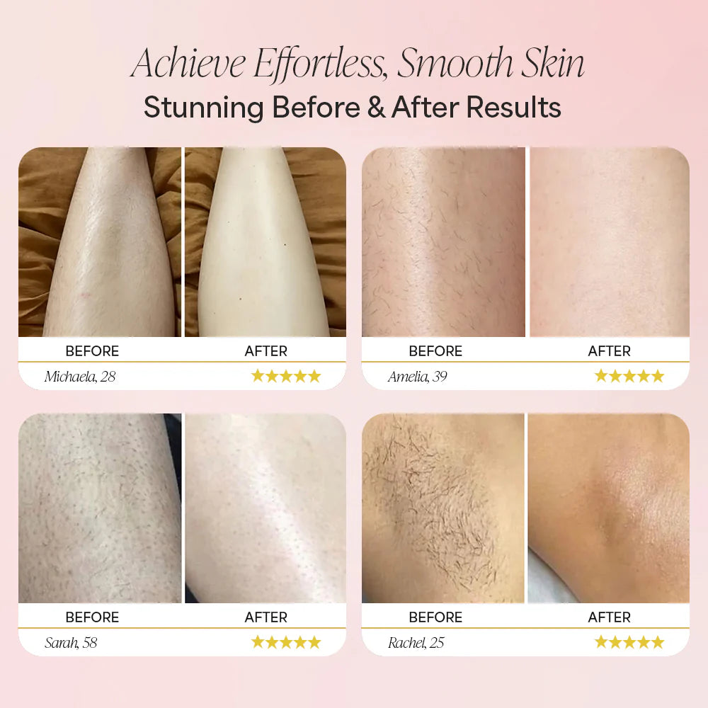 Alveriss Trimmer 2.0